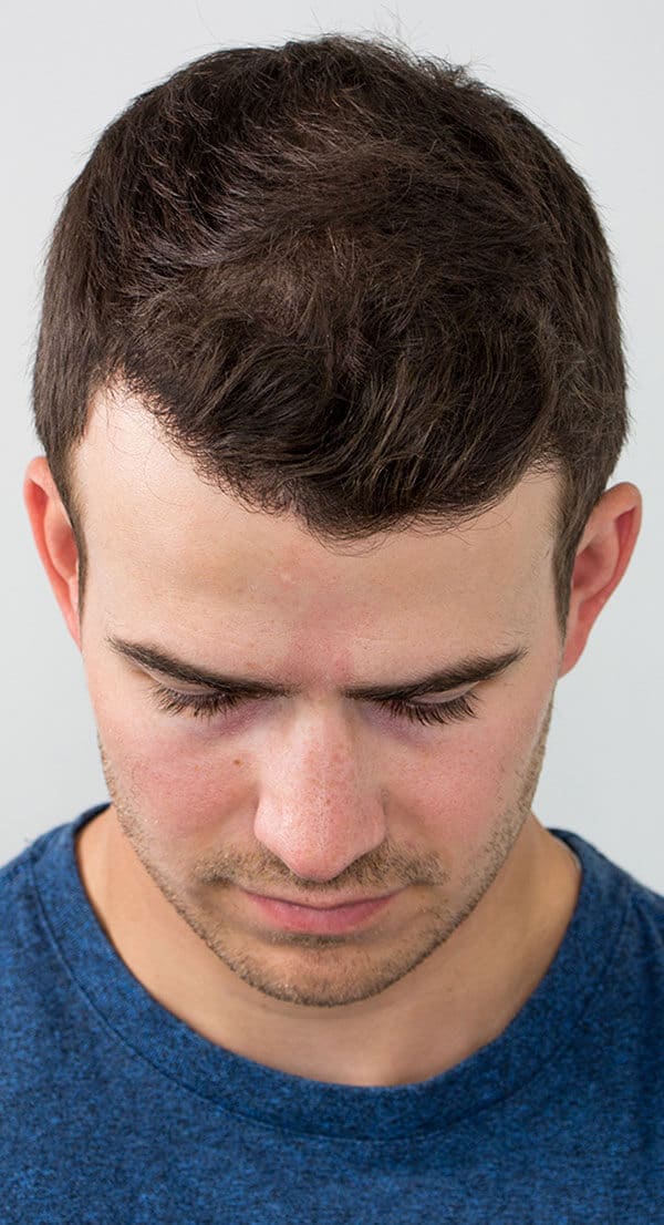 Cole_Front_After