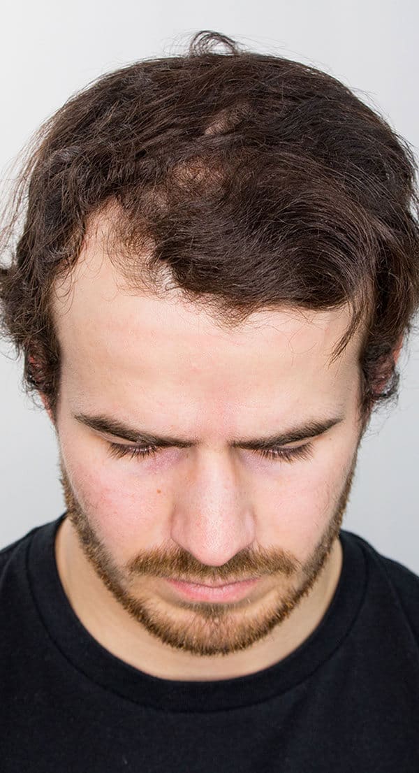 Cole_Front_Before