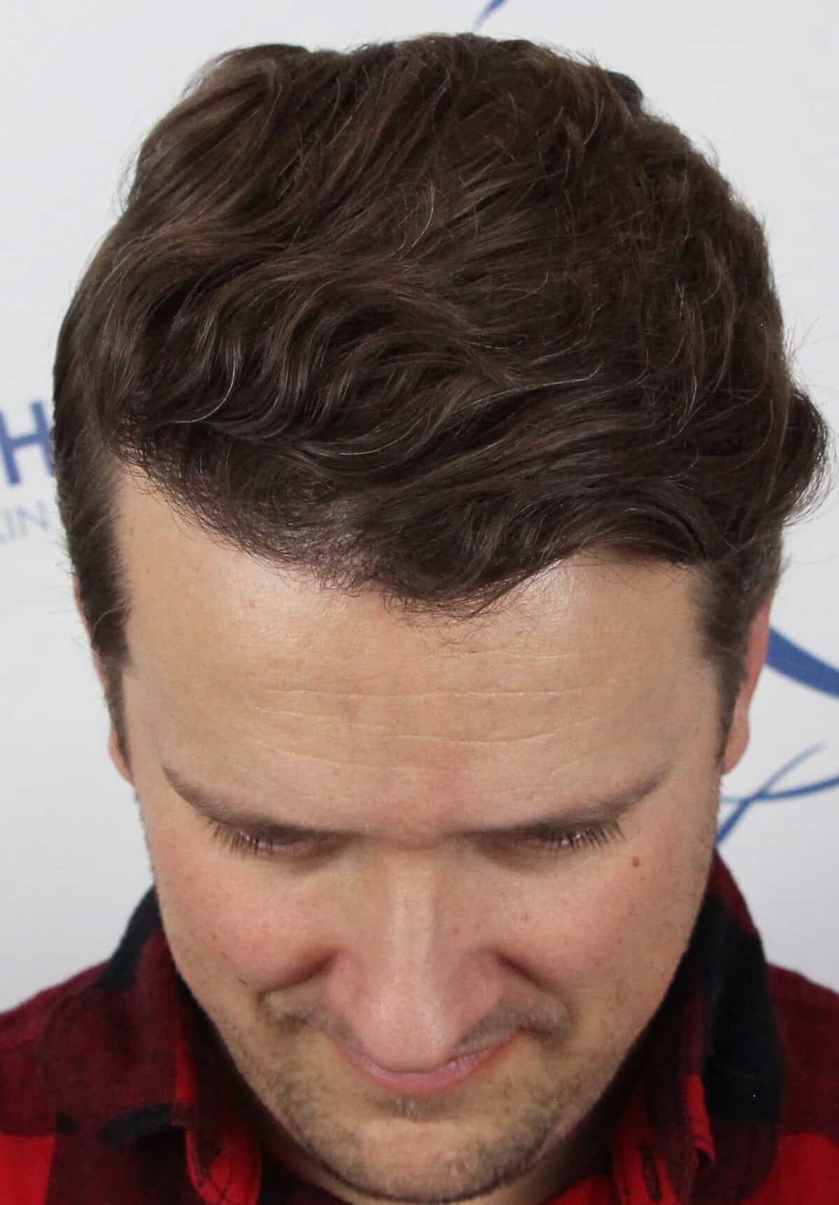 Dav-Lit-After-Front-Tilt