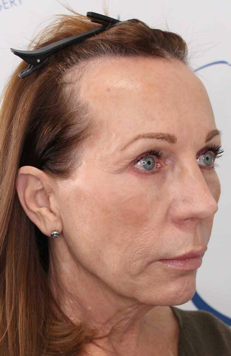 Donna-FUT-45Right-After-NO-ARROW
