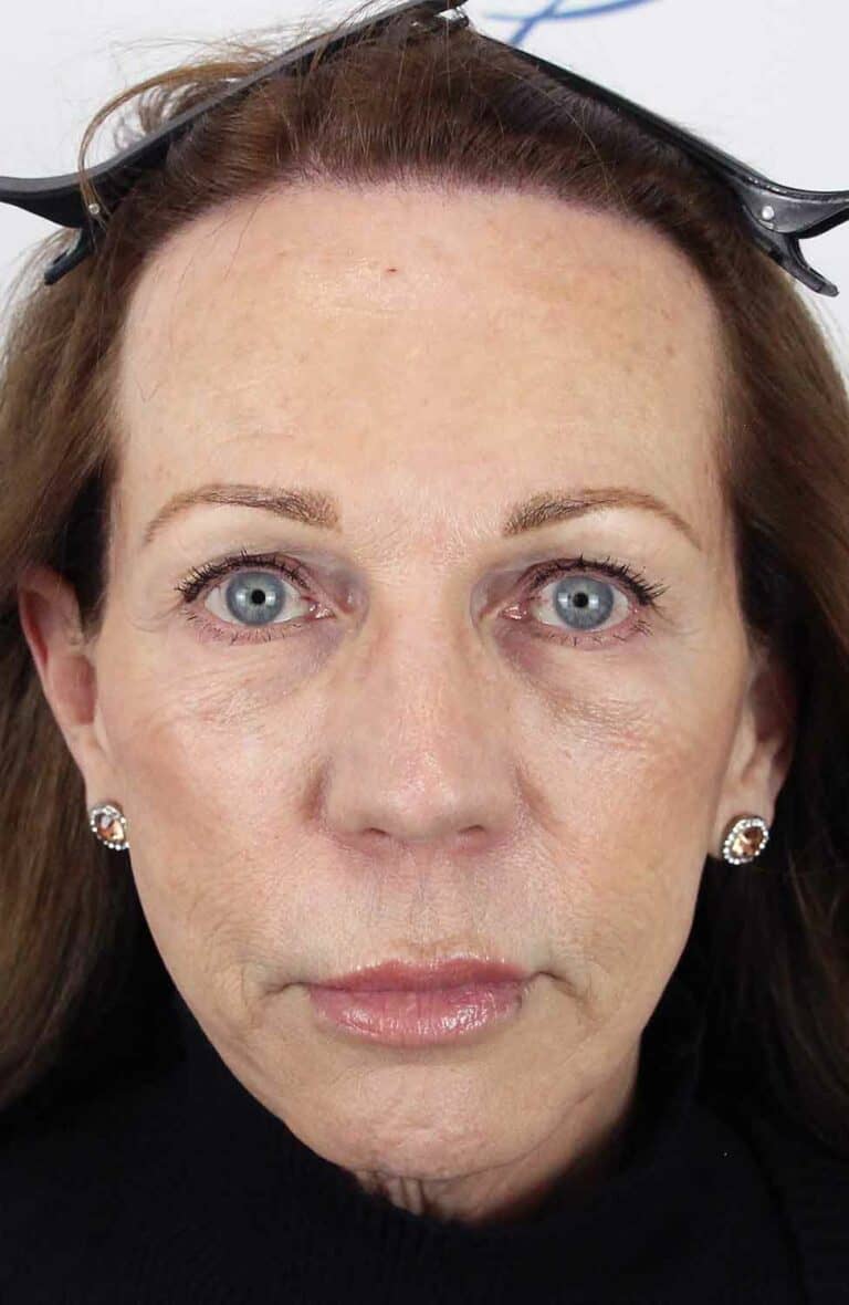 Donna-FUT-Front-After