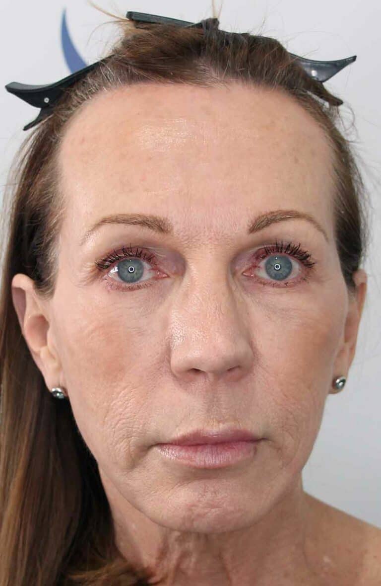 Donna-FUT-Front-Before