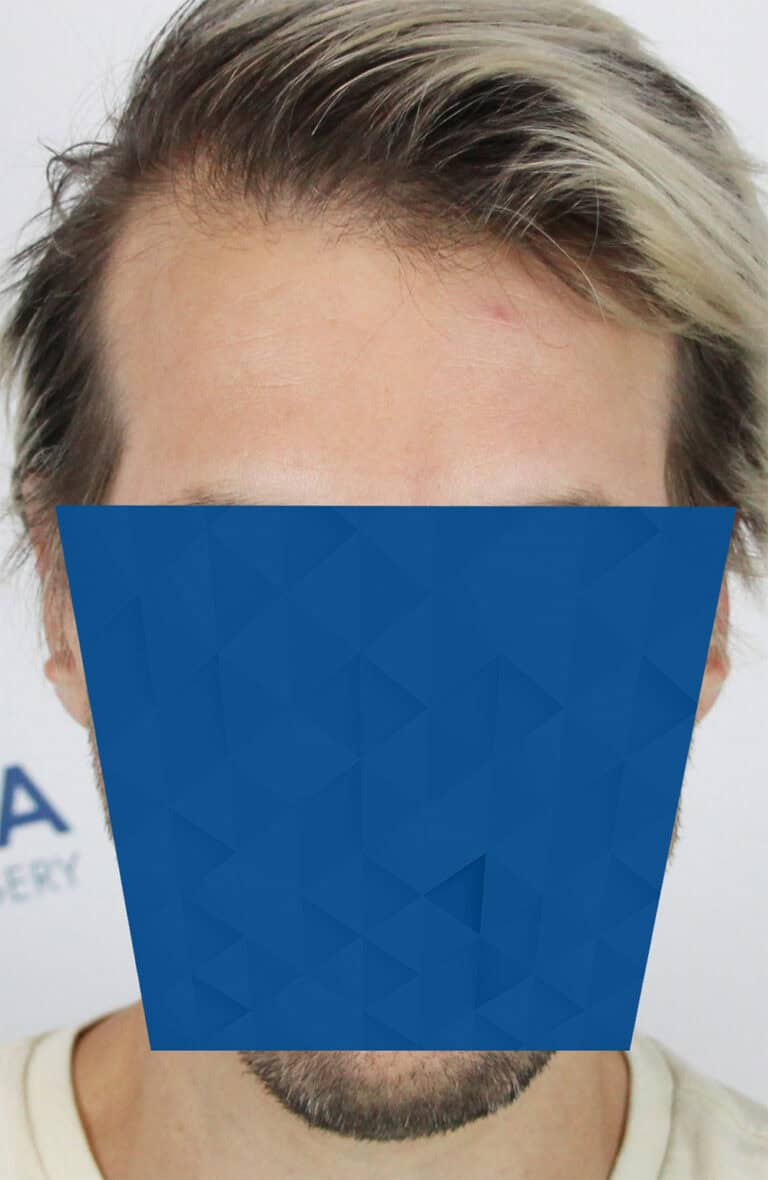 JohnP-RA-Before-Front