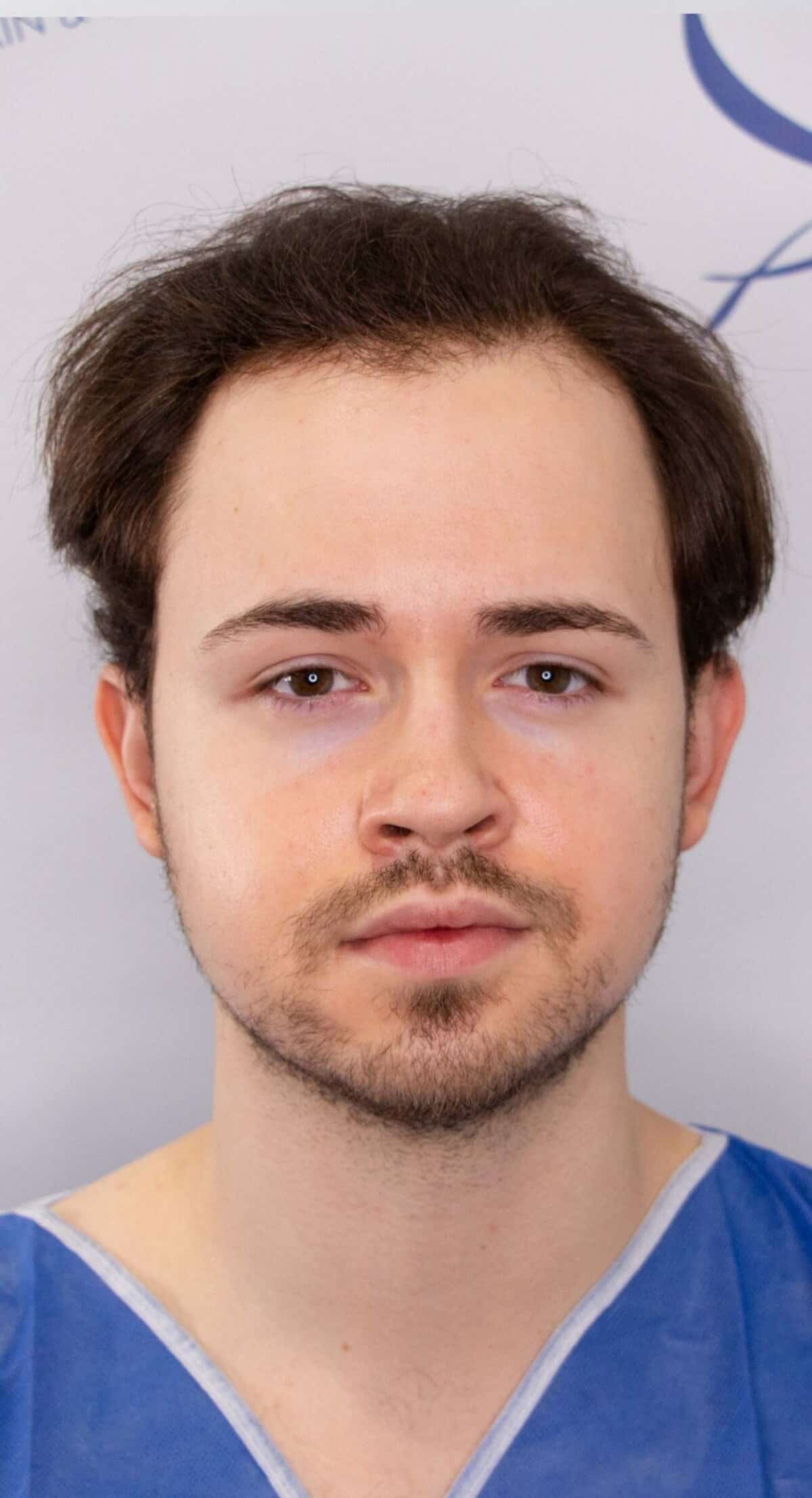 Jordan_Front_Before