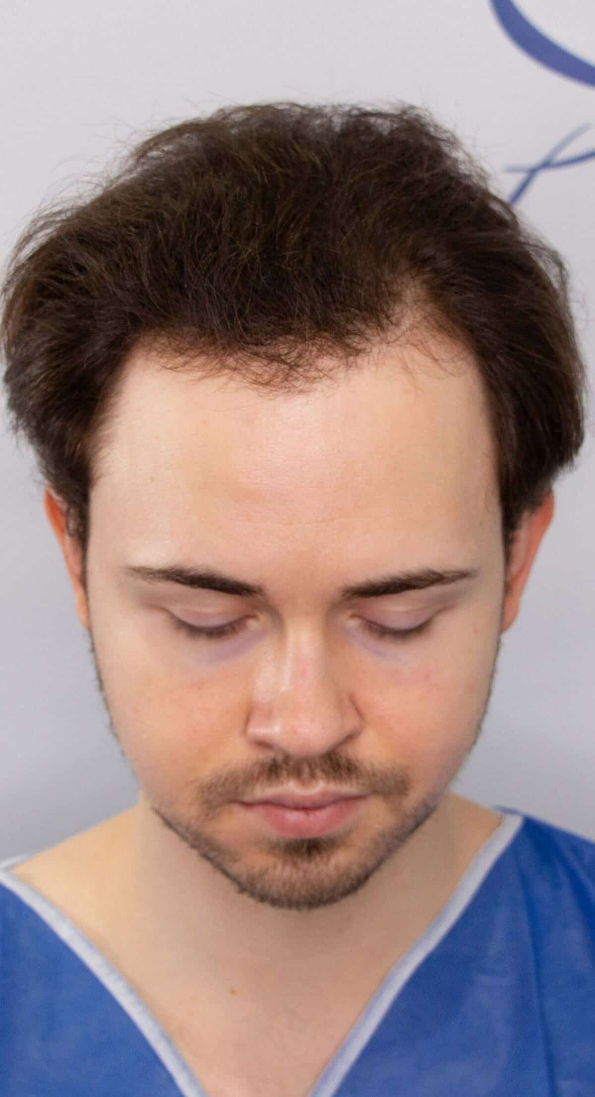 Jordan_Top_before