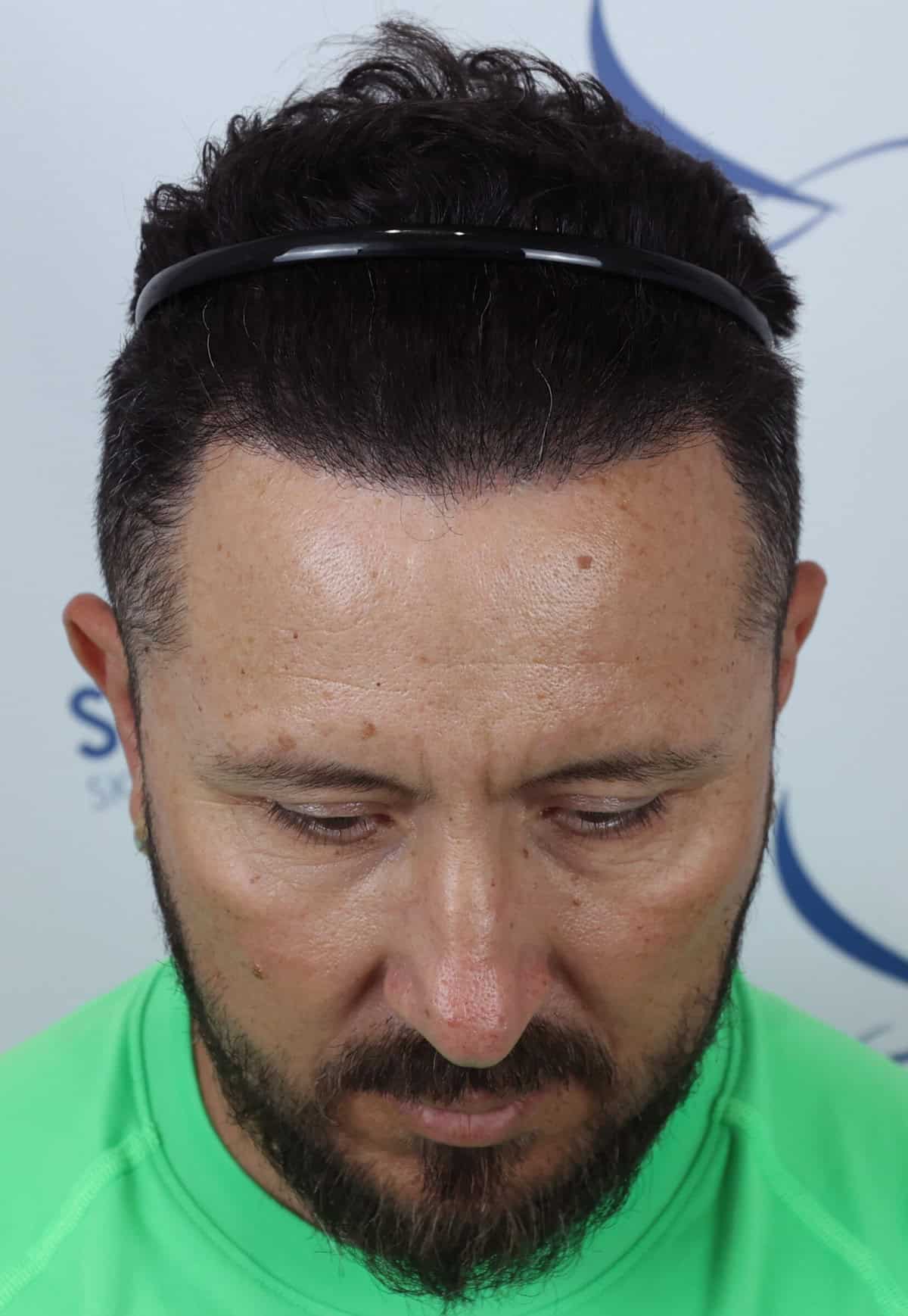 Juan-After-Front