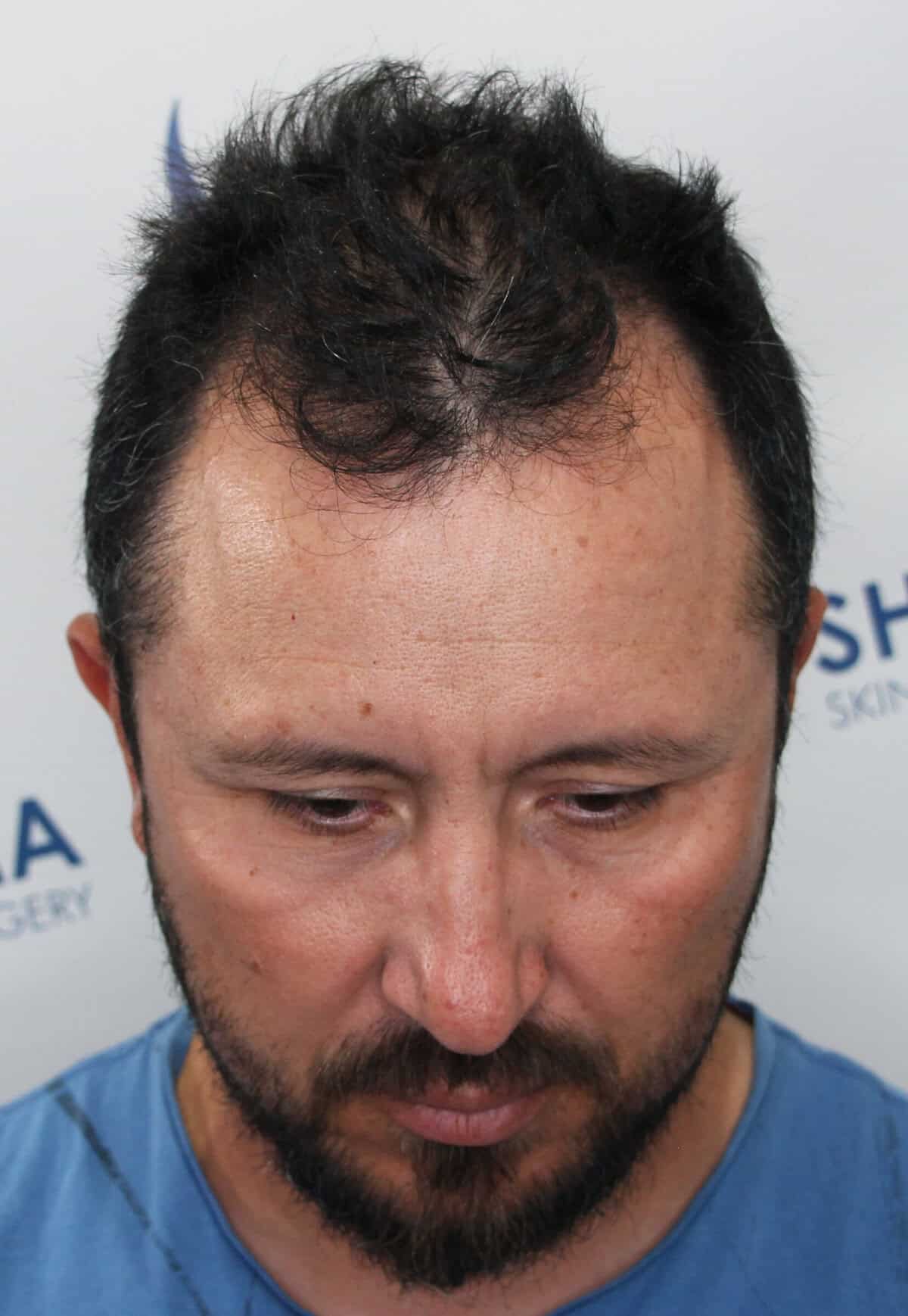 Juan-Before-Front