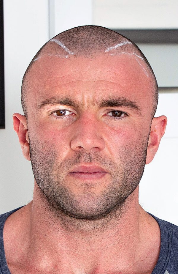 JulianT_Front_Before