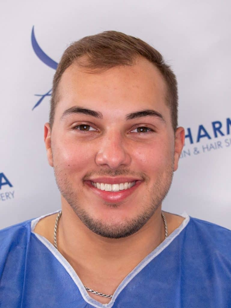 Kaleb-Dahlgren-before-hair-surgery-smiling