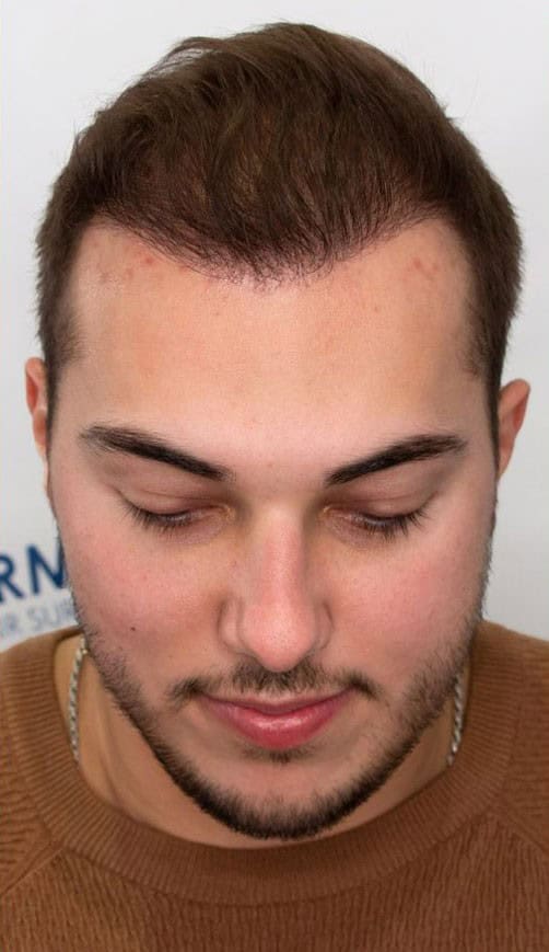 Kaleb_6Month_Top_V1-after