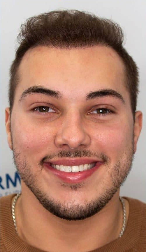 Kaleb_6months_Front_Smile_V1