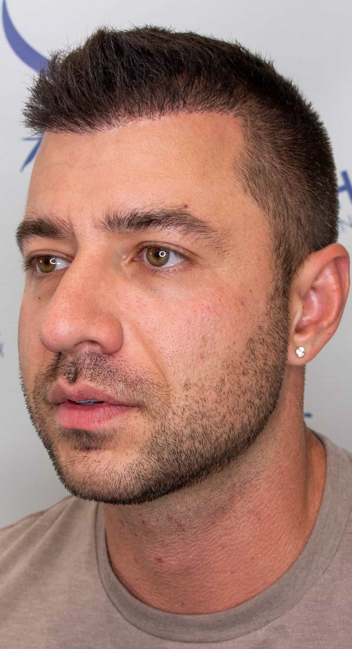 Keith_Left_After-1500×2764-1