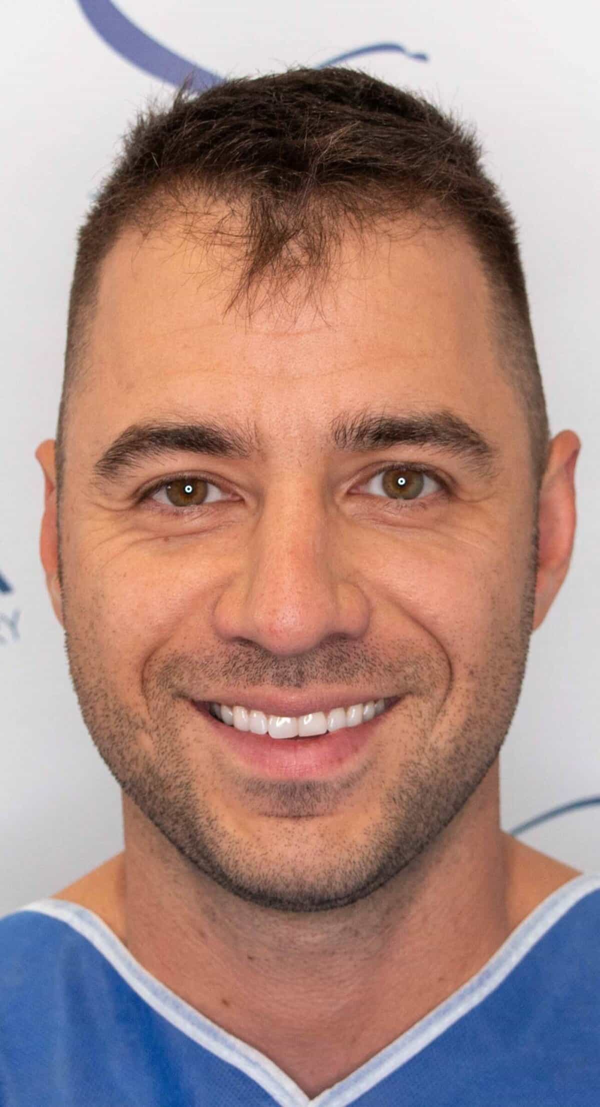 Keith_Left_Front-1500×2764-1