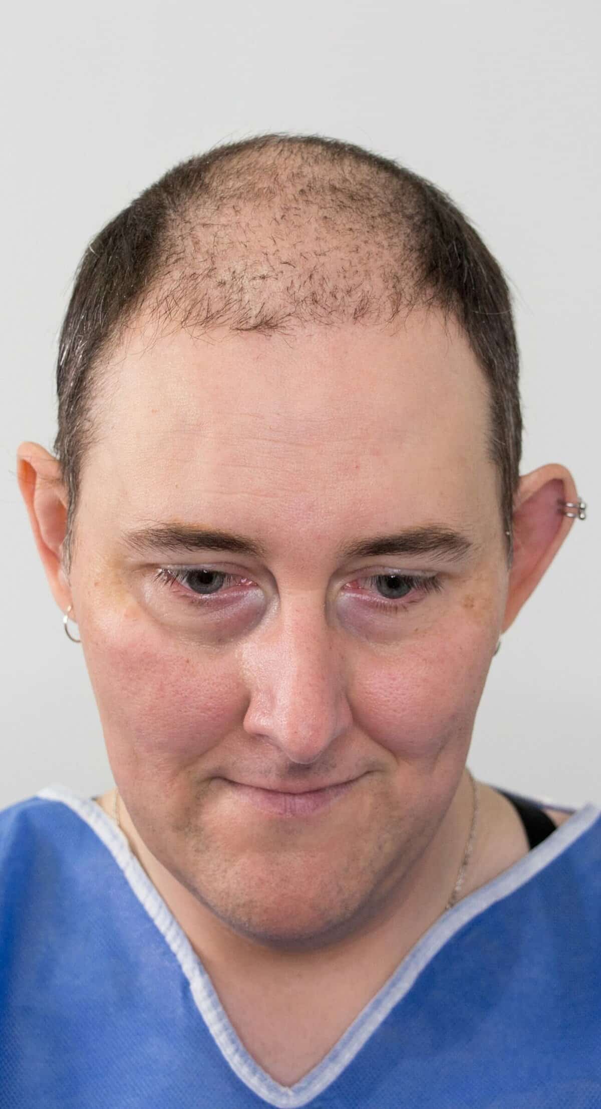 Laura_Front_Before