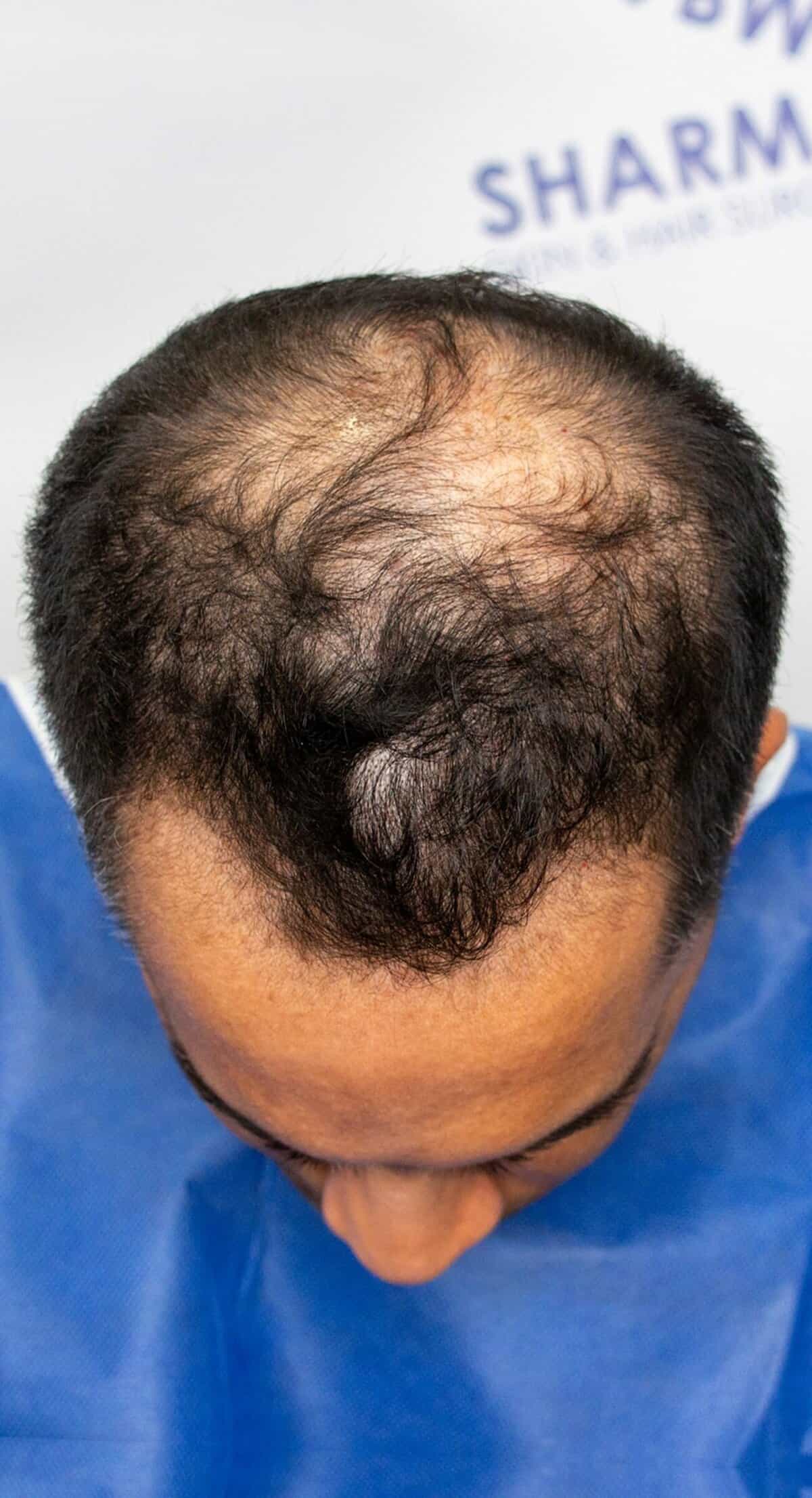 Randy-FrontTop-before