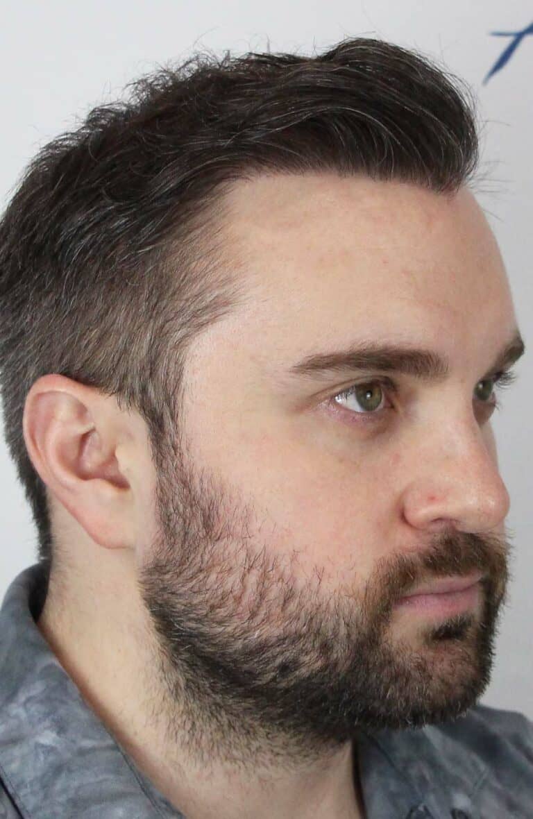 Riley-M-After-45Right