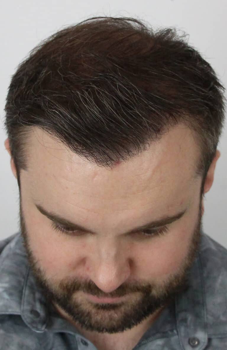 Riley-M-After