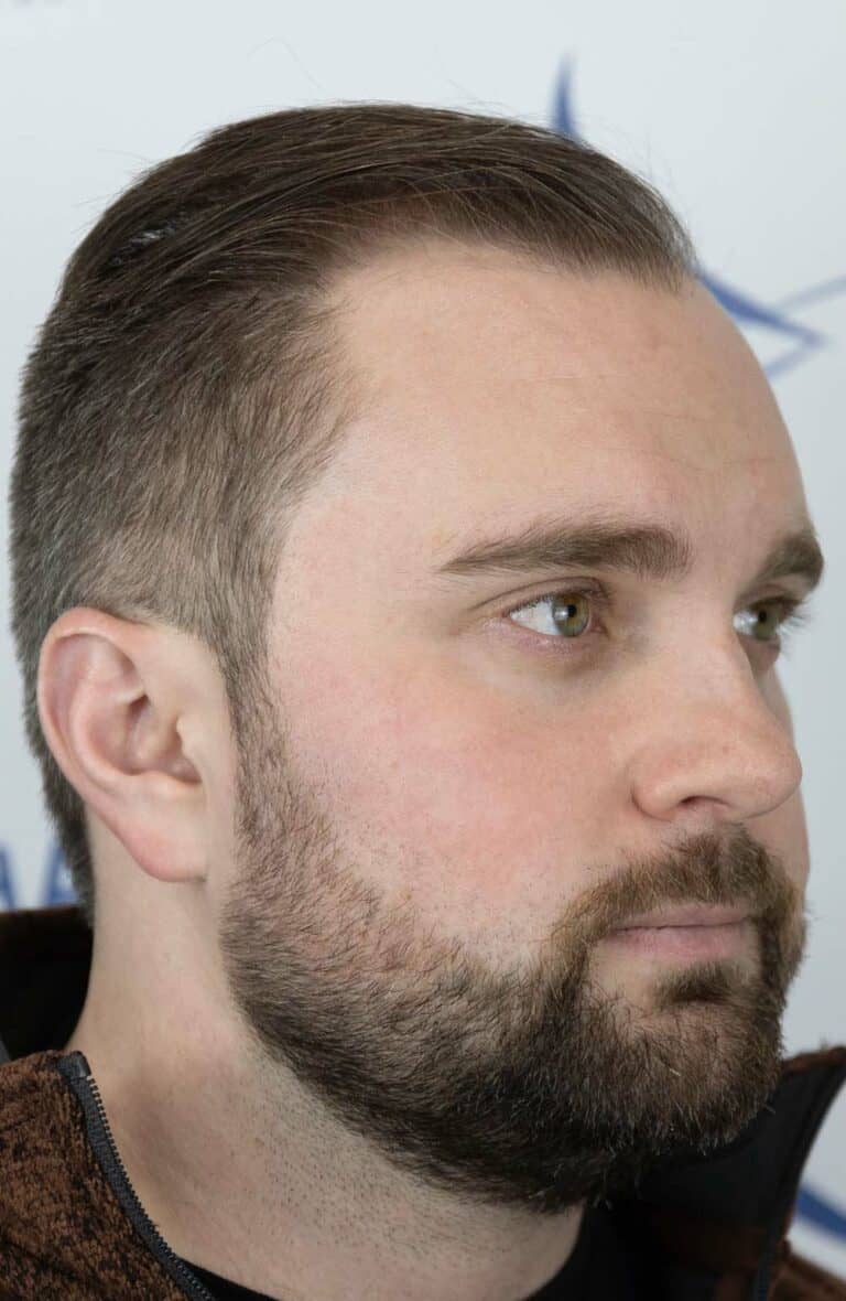 Riley-M-Before-45Right