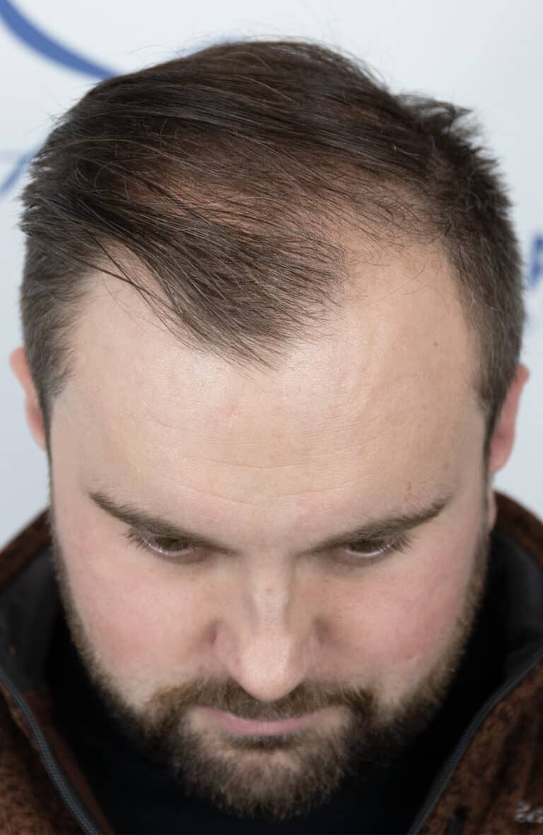 Riley-M-Before
