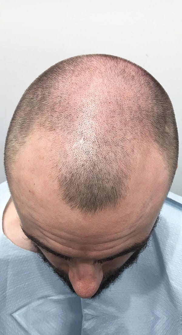 Spencer_Down_before-1