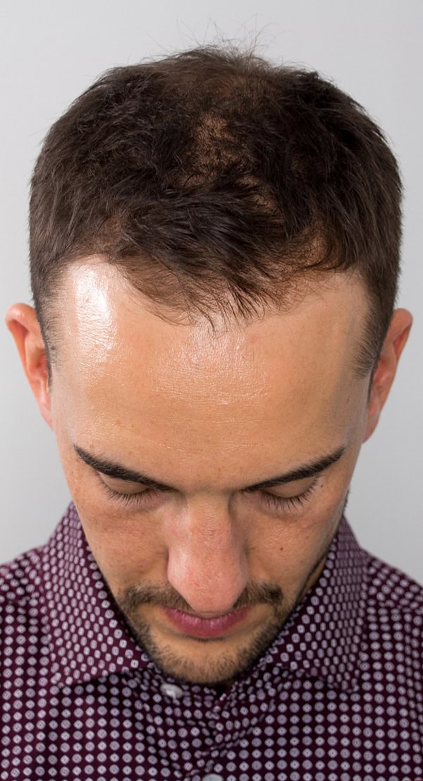 Tristan_Front_Before