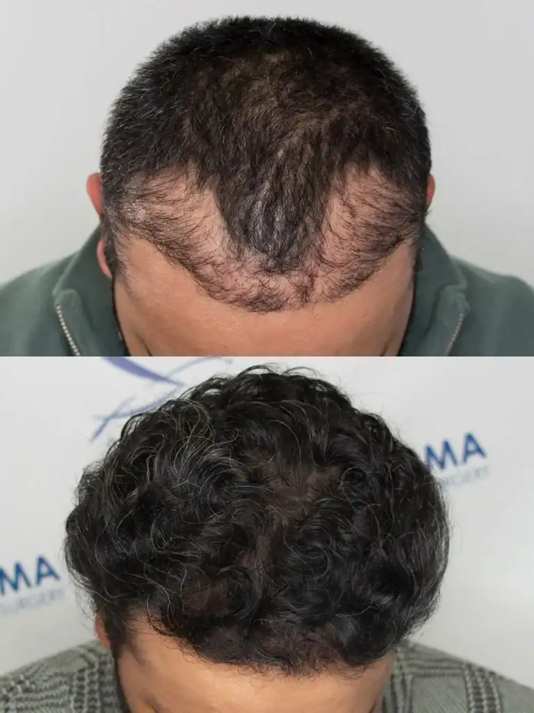 image-anmol-front