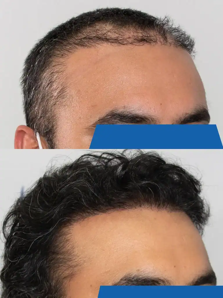 image-anmol-side